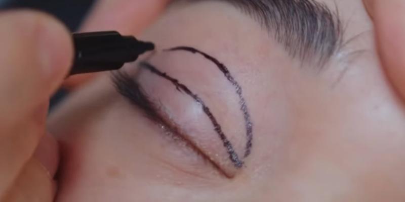 Пластическая хирургия стала новым способом вывода пенсионных средств